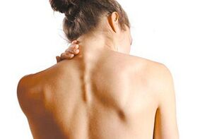 Servikal osteokondroz semptomları